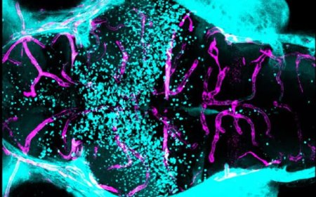 سیگنال ژنتیکی کنترل کننده سد خونی مغزی کشف شد