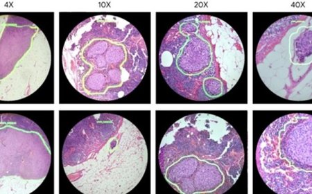 میکروسکوپ جدید با قابلیت شناسایی دقیق‌تر سرطان
