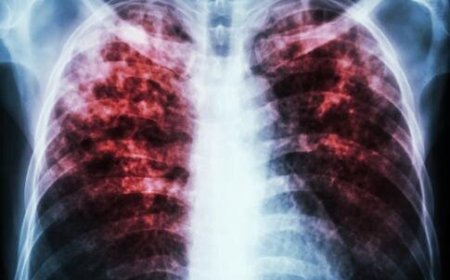 آیا رژیم غذایی می‌تواند جایگزین واکسن سل شود؟