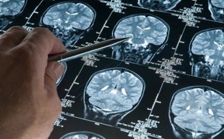 ایران به‌عنوان دومین کشور دنیا موفق به تولید داروی سکته مغزی شد