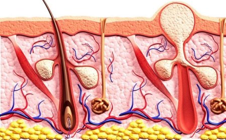 «کورک» چیست و چرا به وجود می‌آید؟