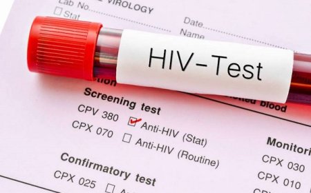 جدیدترین وضعیت بیماری HIV در ایران