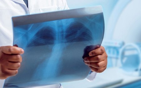 ابتلای 148 نفر به سل در این استان در سال گذشته