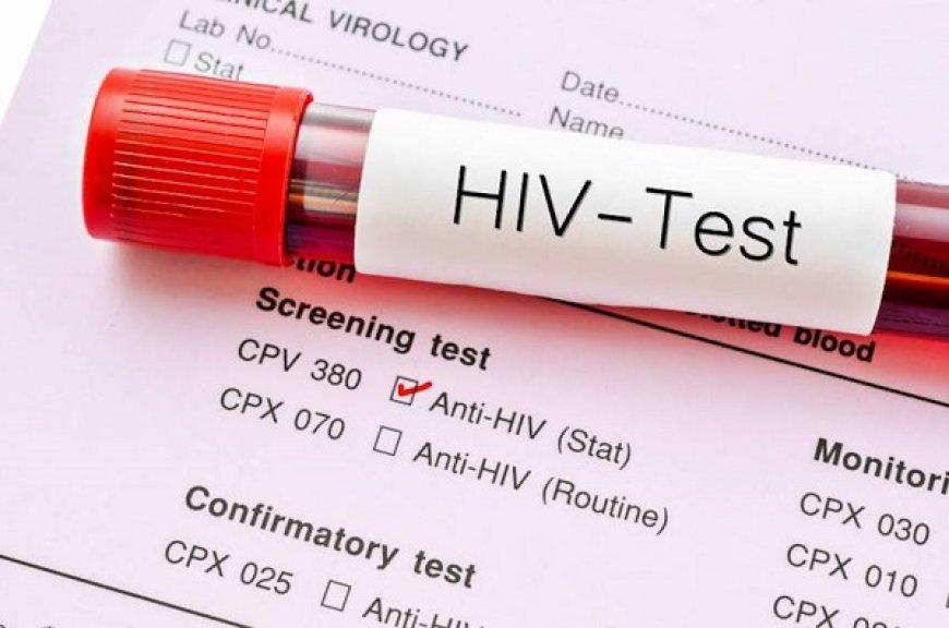 جدیدترین وضعیت بیماری HIV در ایران