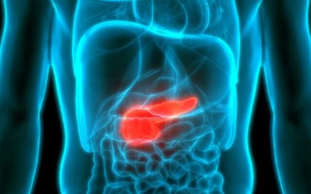 تایید ارتباط سطح بالای انسولین خون با سرطان لوزالمعده