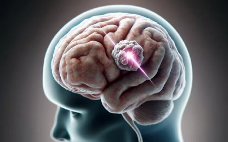 روشن کردن سلول&zwnj;های تومور مغزی با پرتو ایکس و نابودی هدفمند آنها